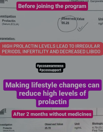 High Prolactin Levels Managed